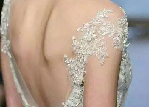 翼状肩=天使翼？其实是一种“病”